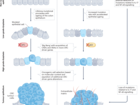 Pathophysiology of colitis-associated colorectal cancer