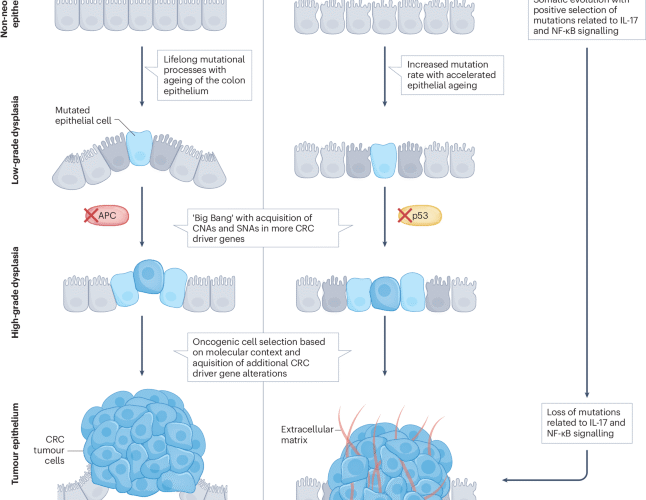 Pathophysiology of colitis-associated colorectal cancer