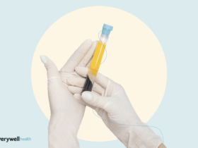 Plasma in the Body: Color, Roles, Donation Uses