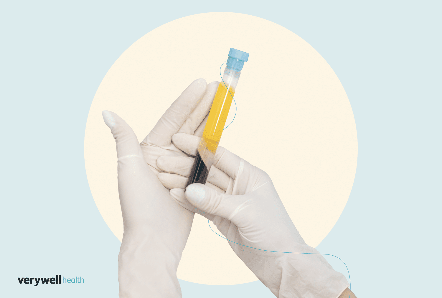 Plasma in the Body: Color, Roles, Donation Uses