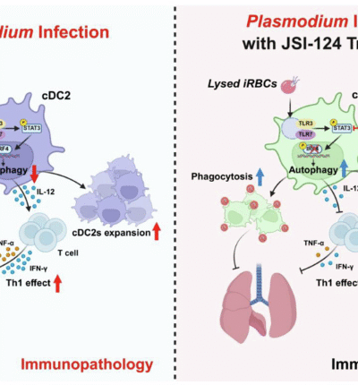 Plasmodium yoelii infection induces lung injury by modulating type 2 conventional dendritic cells autophagy via the STAT3-IRF4 signaling
