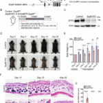 SPT6 maintains epidermal homeostasis by inhibiting an NF-κB-positive feedback loop to prevent excessive inflammation