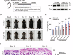 SPT6 maintains epidermal homeostasis by inhibiting an NF-κB-positive feedback loop to prevent excessive inflammation