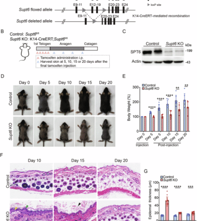 SPT6 maintains epidermal homeostasis by inhibiting an NF-κB-positive feedback loop to prevent excessive inflammation