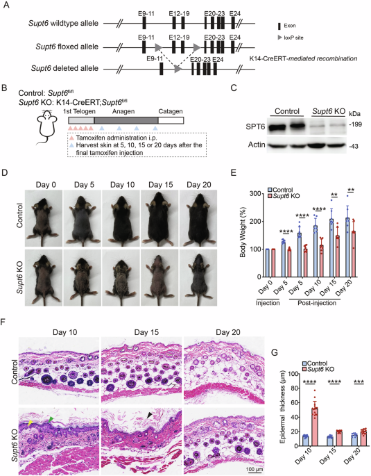 SPT6 maintains epidermal homeostasis by inhibiting an NF-κB-positive feedback loop to prevent excessive inflammation