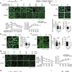 STING is the scaffold protein for stress granule pre-condensation at the ER