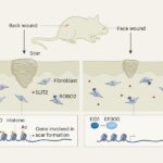 Saving face: why facial scars are smaller than back scars
