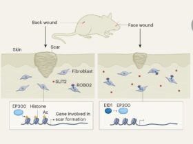 Saving face: why facial scars are smaller than back scars