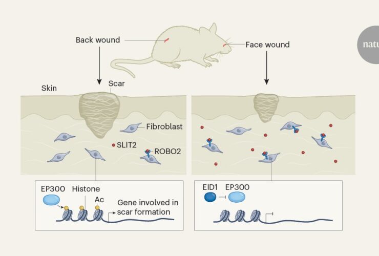 Saving face: why facial scars are smaller than back scars