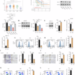 Secreted SULF1 protein modulates CD8 + T cell exhaustion by promoting TAM polarization in gastric cancer