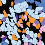 Single-cell TCR mapping reveals spatially coordinated T cell states in head and neck cancer | Science Immunology