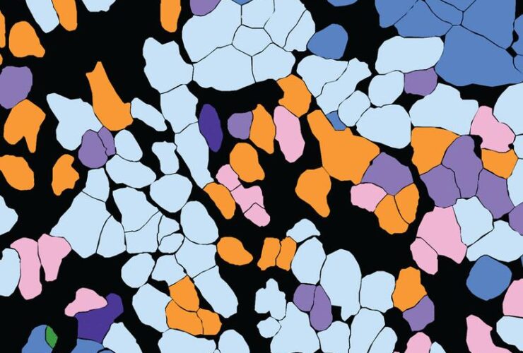 Single-cell TCR mapping reveals spatially coordinated T cell states in head and neck cancer | Science Immunology