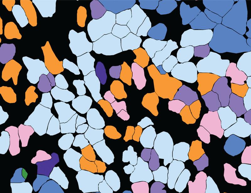 Single-cell TCR mapping reveals spatially coordinated T cell states in head and neck cancer | Science Immunology