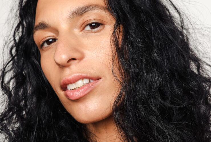 Soothe Irritated Skin: Causes, Remedies & A Derm's Expert Tips