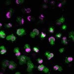 The autoantigen TRIM21 assembles proinflammatory immune complexes after lytic cell death | Science Immunology