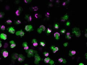 The autoantigen TRIM21 assembles proinflammatory immune complexes after lytic cell death | Science Immunology