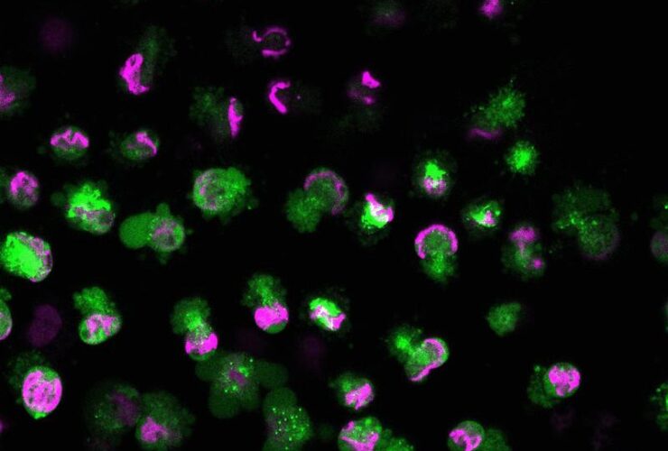 The autoantigen TRIM21 assembles proinflammatory immune complexes after lytic cell death | Science Immunology