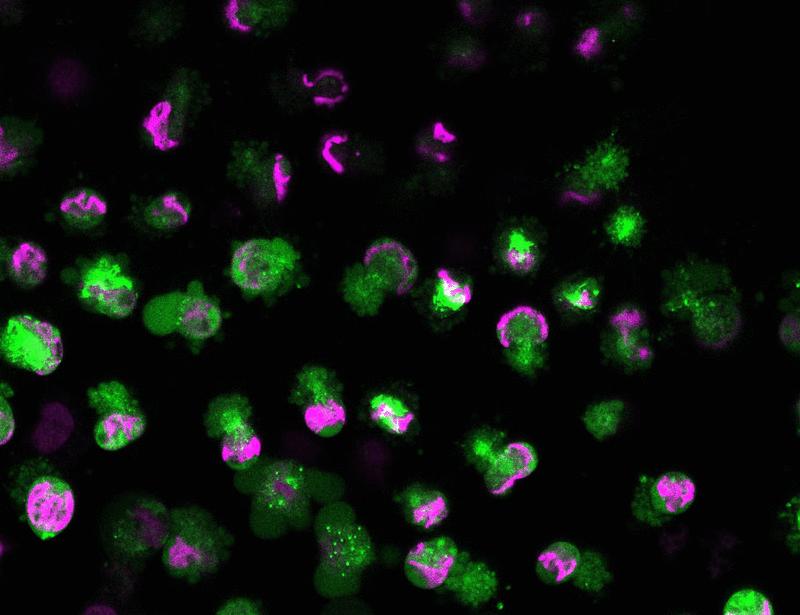 The autoantigen TRIM21 assembles proinflammatory immune complexes after lytic cell death | Science Immunology