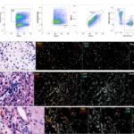 Tissue resident memory T cells populate the human uveal tract
