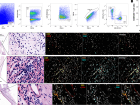 Tissue resident memory T cells populate the human uveal tract