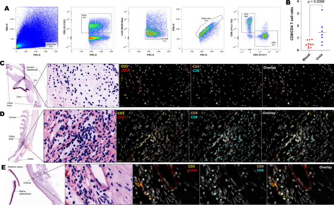 Tissue resident memory T cells populate the human uveal tract