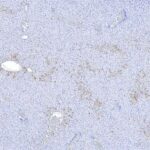 Upstream ORFs control TNFR1 abundance and tissue tolerance to TNF | Science Immunology