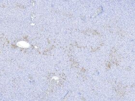 Upstream ORFs control TNFR1 abundance and tissue tolerance to TNF | Science Immunology