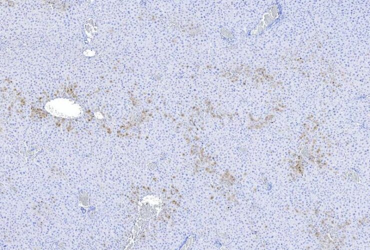 Upstream ORFs control TNFR1 abundance and tissue tolerance to TNF | Science Immunology