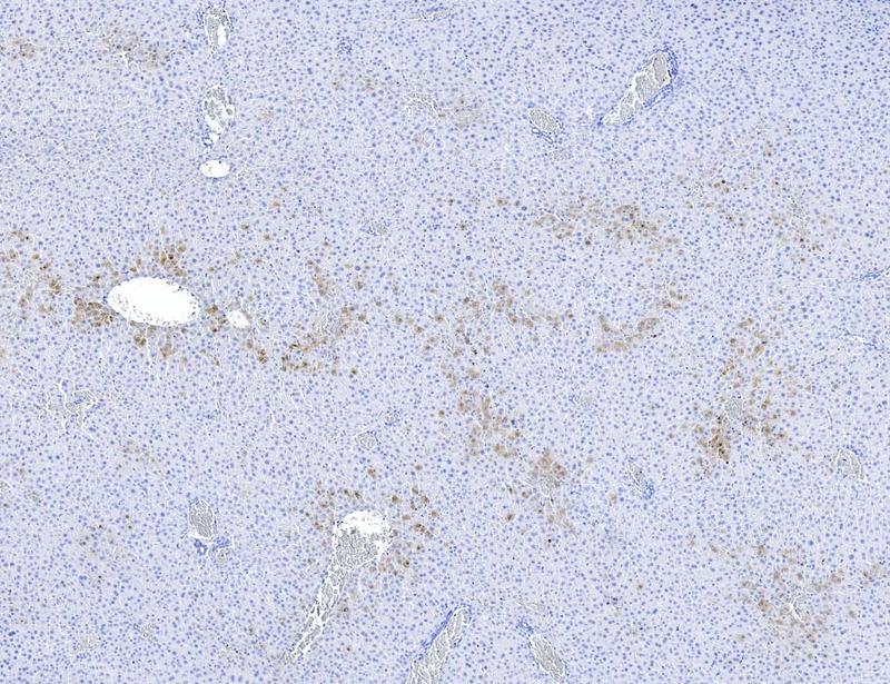 Upstream ORFs control TNFR1 abundance and tissue tolerance to TNF | Science Immunology