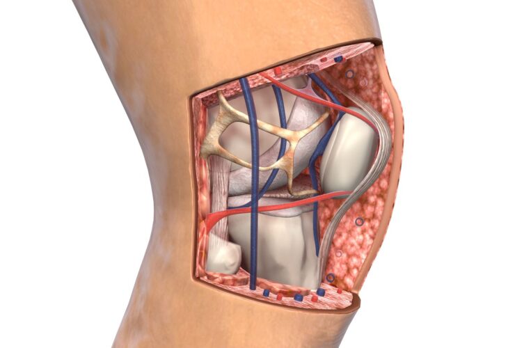 What Causes a Patellar Tendon Tear and How to Treat It