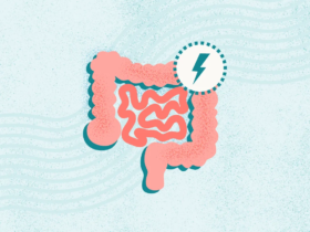 What Is Irritable Bowel Syndrome (IBS)?