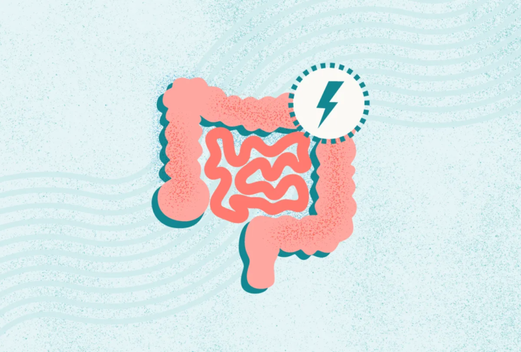 What Is Irritable Bowel Syndrome (IBS)?