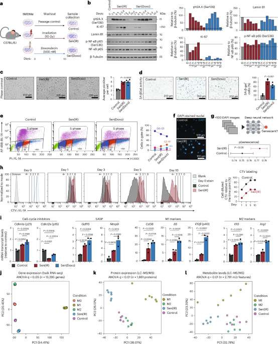 p21+TREM2+ senescent macrophages fuel inflammaging and metabolic dysfunction-associated steatotic liver disease