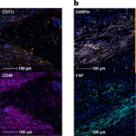 Activation of CD40 in tumors reprograms the tumor microenvironment