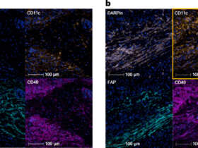 Activation of CD40 in tumors reprograms the tumor microenvironment