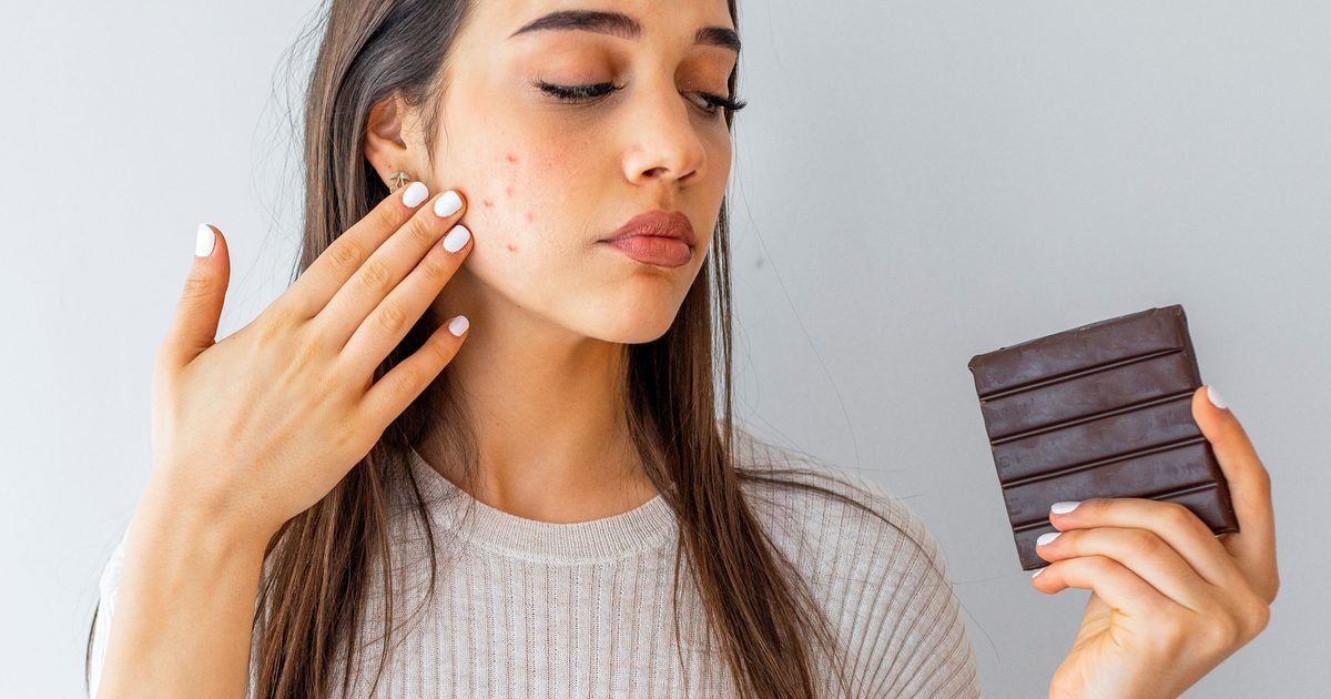 Can diet cause acne? | Good Food