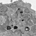 Citraconate preserves T cell stemness and antitumor immunity | Science Immunology