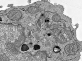 Citraconate preserves T cell stemness and antitumor immunity | Science Immunology