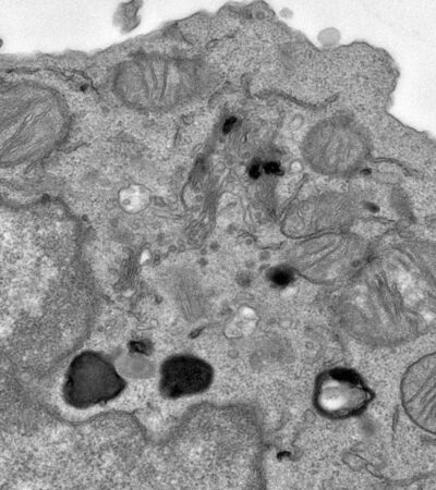 Citraconate preserves T cell stemness and antitumor immunity | Science Immunology