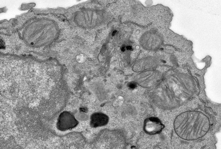 Citraconate preserves T cell stemness and antitumor immunity | Science Immunology