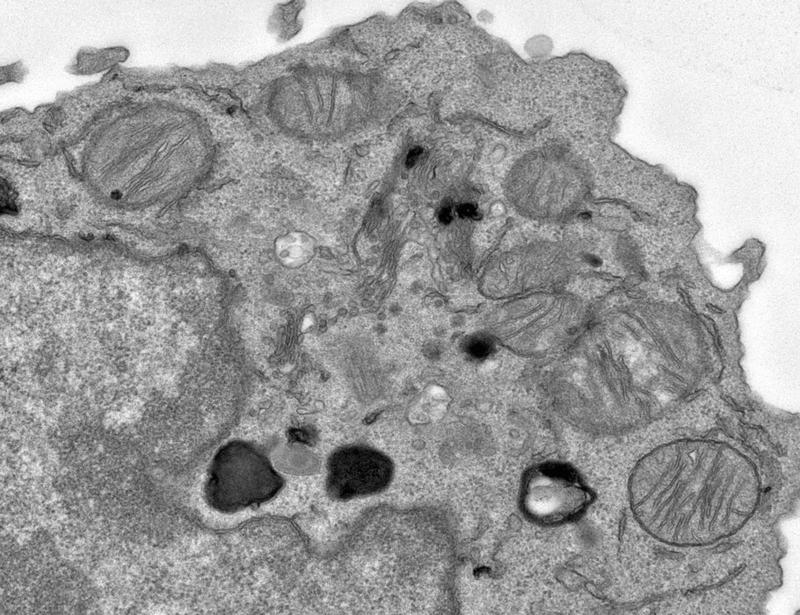 Citraconate preserves T cell stemness and antitumor immunity | Science Immunology