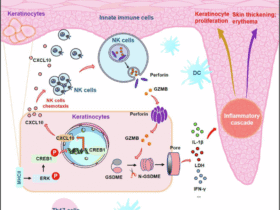 Epidermal MHC-II-mediated NK cell recruitment triggers keratinocyte pyroptosis, facilitating pathogenesis of psoriasis