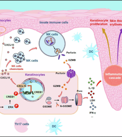Epidermal MHC-II-mediated NK cell recruitment triggers keratinocyte pyroptosis, facilitating pathogenesis of psoriasis