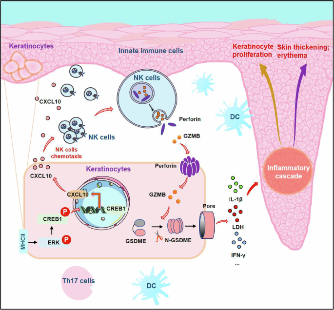 Epidermal MHC-II-mediated NK cell recruitment triggers keratinocyte pyroptosis, facilitating pathogenesis of psoriasis