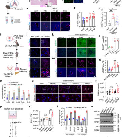 Exosomal ORF3a mediates lung-liver axis to dysregulate hepatic lipid metabolism in mild COVID-19