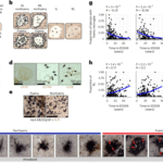 Foamy microglia link oxylipins to disease progression in multiple sclerosis