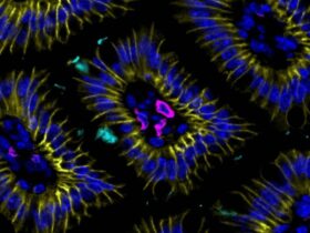 Goblet cells tune ILC2 activity through a gut-specific response checkpoint | Science Immunology