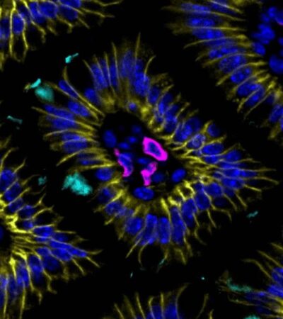 Goblet cells tune ILC2 activity through a gut-specific response checkpoint | Science Immunology