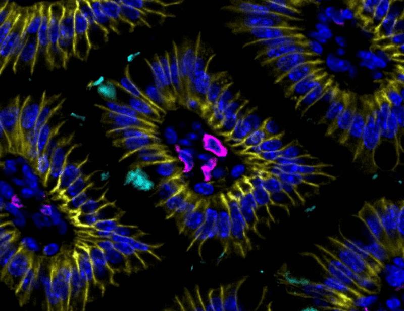 Goblet cells tune ILC2 activity through a gut-specific response checkpoint | Science Immunology