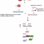 Hyperactivation of the cGAS-STING pathway promotes liver inflammation in Down syndrome